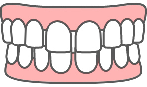 歯と歯の間にスペースがあるすきっ歯のイラスト